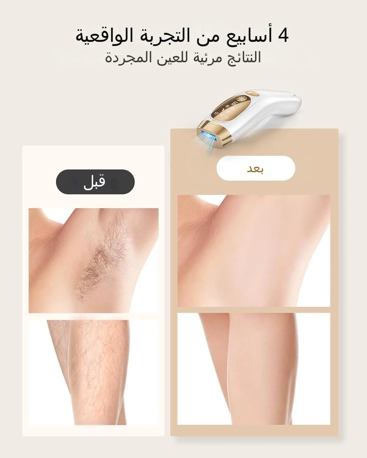 Laser Hair Removal IPL Device Unlimited Flashes Ice-Cooling Painless Whole Body Treament Safe Quick Home Epilator Hair Removal