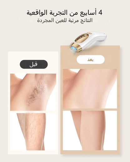 Laser Hair Removal IPL Device Unlimited Flashes Ice-Cooling Painless Whole Body Treament Safe Quick Home Epilator Hair Removal